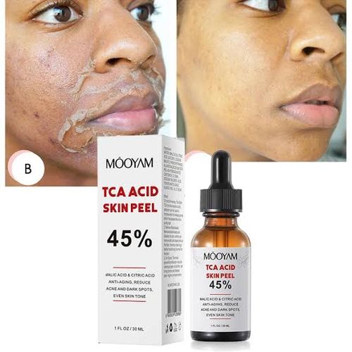 MOOYAM TCA Acid Skin Peel 45% 30ml - Image 1