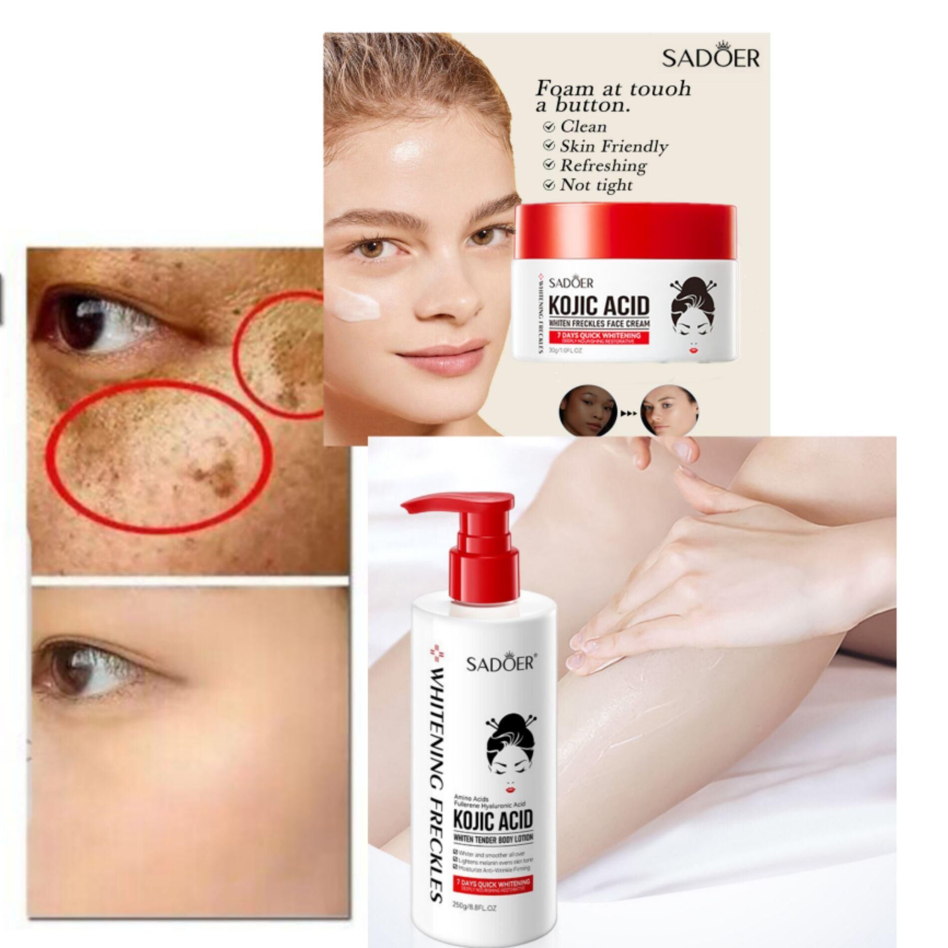 gvc.product.image_.1749308109850.f2535f0f-ee2f-41b9-a9f7-b6502dd8ac9b.jpeg Kojic acid freckles cream + lotion