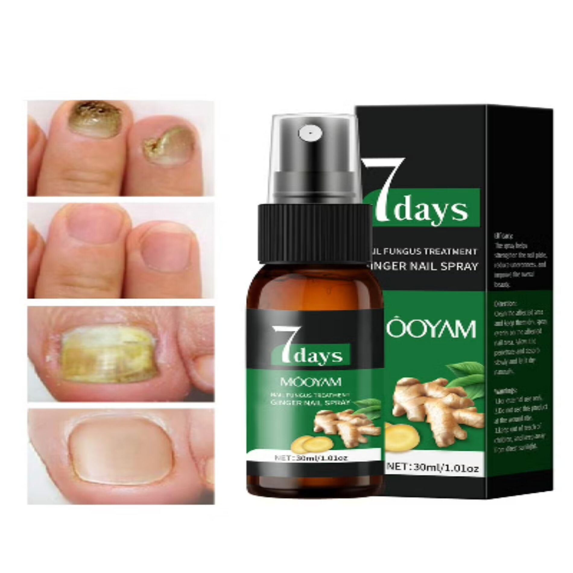 7days fungus nail spray