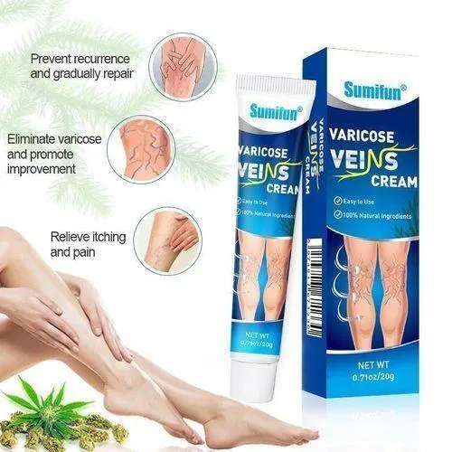 Varicose Veins Cream