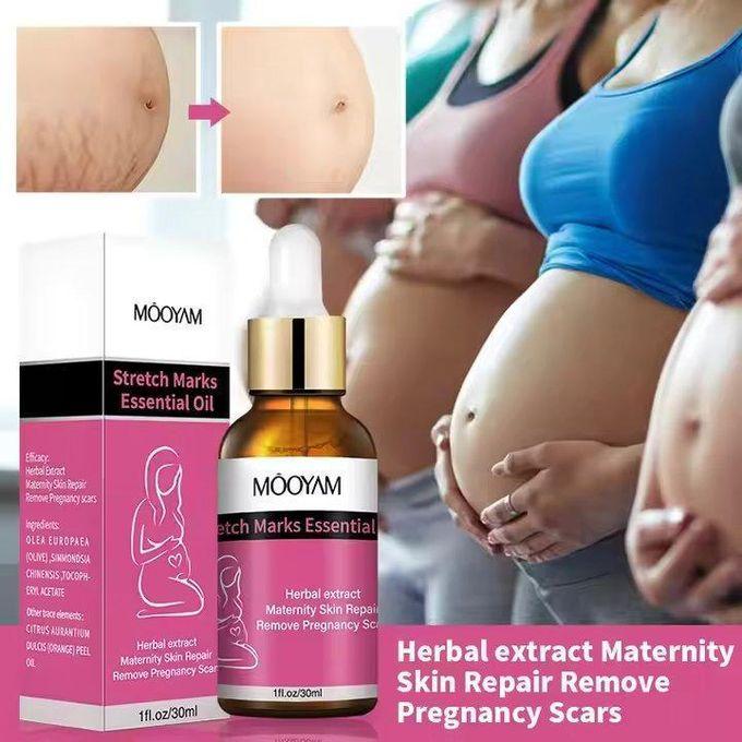 Stretch marks essential oil 30ml