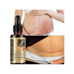 Lavender Repair Essence Stretch Mark & Scar Remover