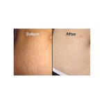 Pasjel Stretch Marks And Scar Removal Cream - Image 4