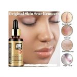 Clothes Of Skin Lavender Skin Repair Essence For Scar -3 Pcs - Image 3