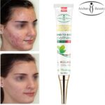 Aichun Beauty Kind To Skin Acne Cream 30ml