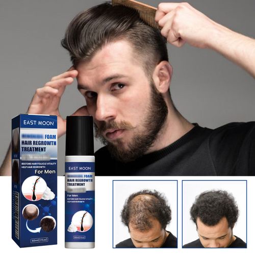 1 - 2024-11-23T204205.534 East moon 5% Minoxidil Hair ReGrowth Treatment, Can Foam Aerosol - Image 1