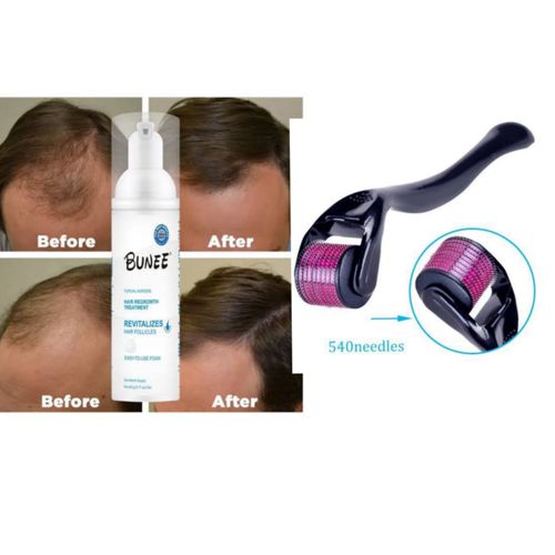 Hair Regrowth Treatment Foam 60g & 1.5m Derma Roller