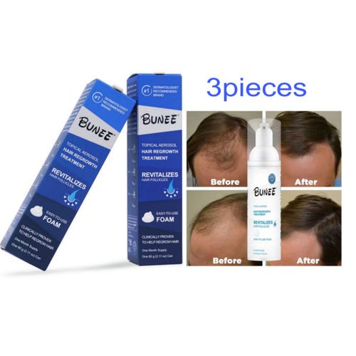 Hair Regrowth Treatment Foam 60g ×3