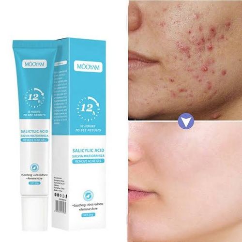 Salicylic Acid Remove Acne Gel 20g