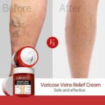 Varicose Veins Relief Cream 80g