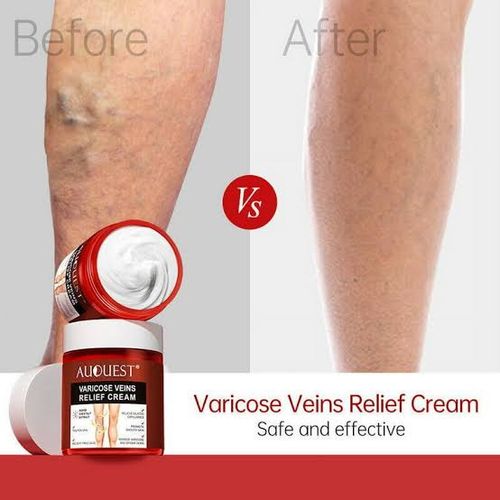 Varicose Veins Relief Cream 80g