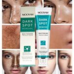 Dark Spot Removal Whitening Freckle Cream 30g