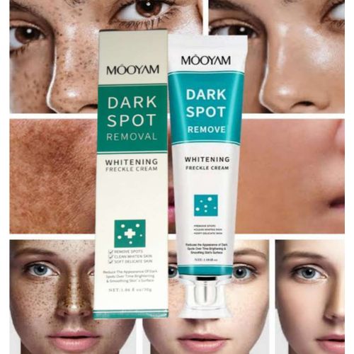 Dark Spot Removal Whitening Freckle Cream 30g