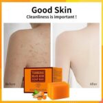 Turmeric Kojic Acid Soap Bar 200g