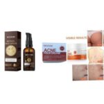 Retinol Face Serum 50ml & Acne Face Cream 30g
