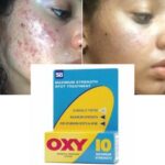 Oxy 10 Benzoyl Peroxide Lotion Fr Spot & Acne Treatment
