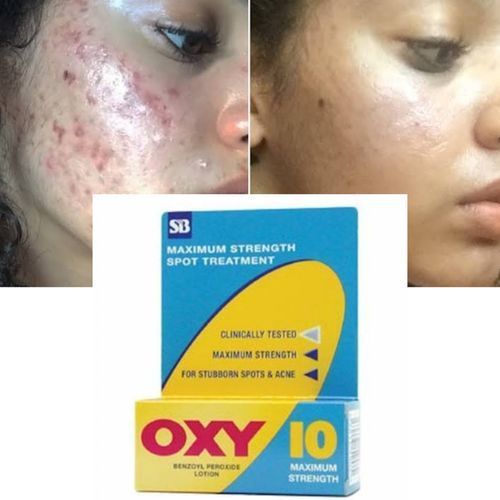 Oxy 10 Benzoyl Peroxide Lotion Fr Spot & Acne Treatment