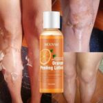 MOOYAM Orange Peeling Lotion Extra Strong Removes Dead Skin