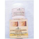 Stretch Marks Cream