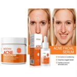 Acne facial cream & face serum