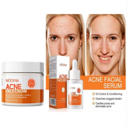 Acne facial cream & face serum