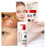 Kojic acid freckles cream + lotion