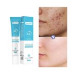 12 hour Salicylic acid remove acne gel
