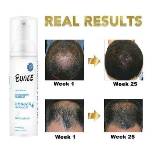 Signature 5% Minoxidil Hair Growth, Can Foam Aerosol