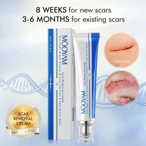 Scar Removal cream