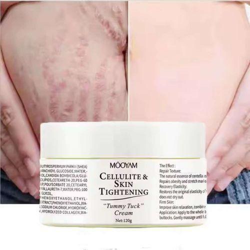 Cellulite & Skin Tightening Tummy Tuck Cream