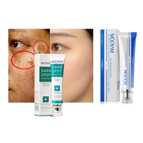 Dark/freckle spot removal + scar removal cream
