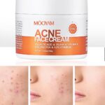 Acne face cream
