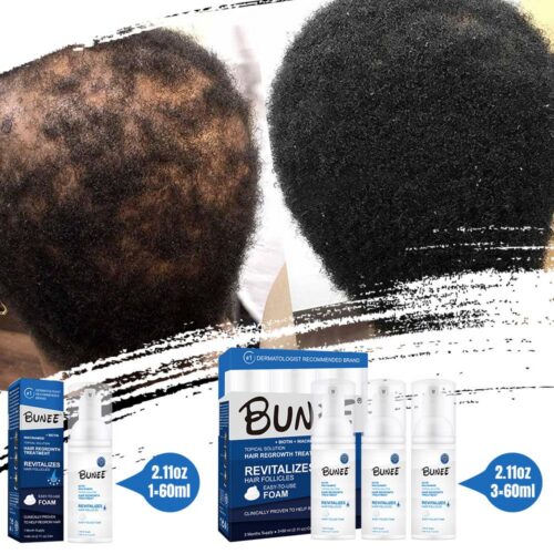 Hair regrowth treatment foam pack of 3pcs