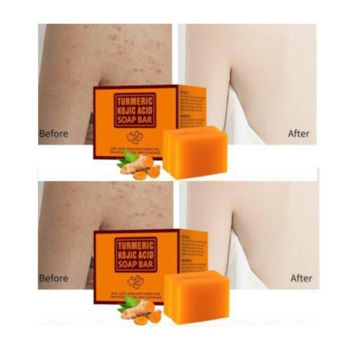 Turmeric acid soap bar ×2