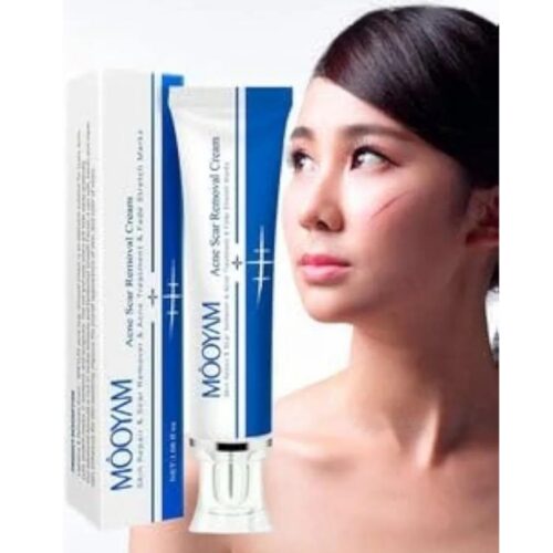 Scar removal cream