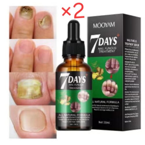 Nail fungus treatment ×2